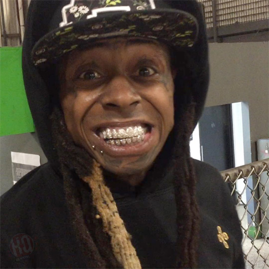 lil wayne teeth before and after